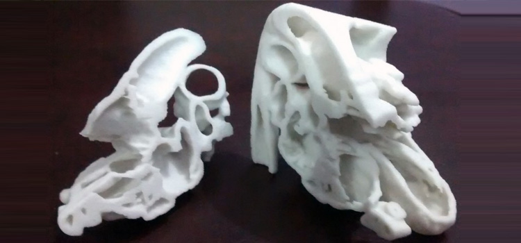 Cuore-stampato-in-3D
