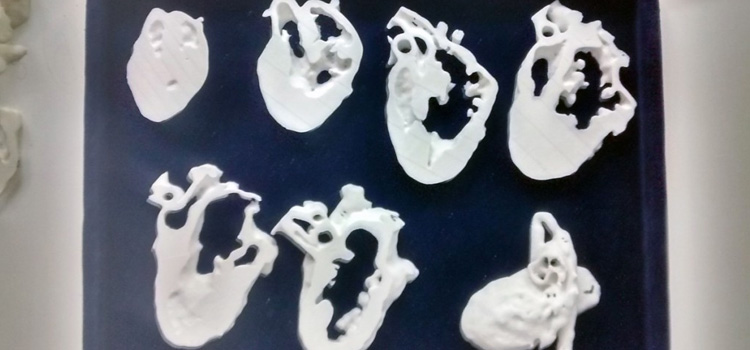 Sezioni-cuore-stampato-in-3D